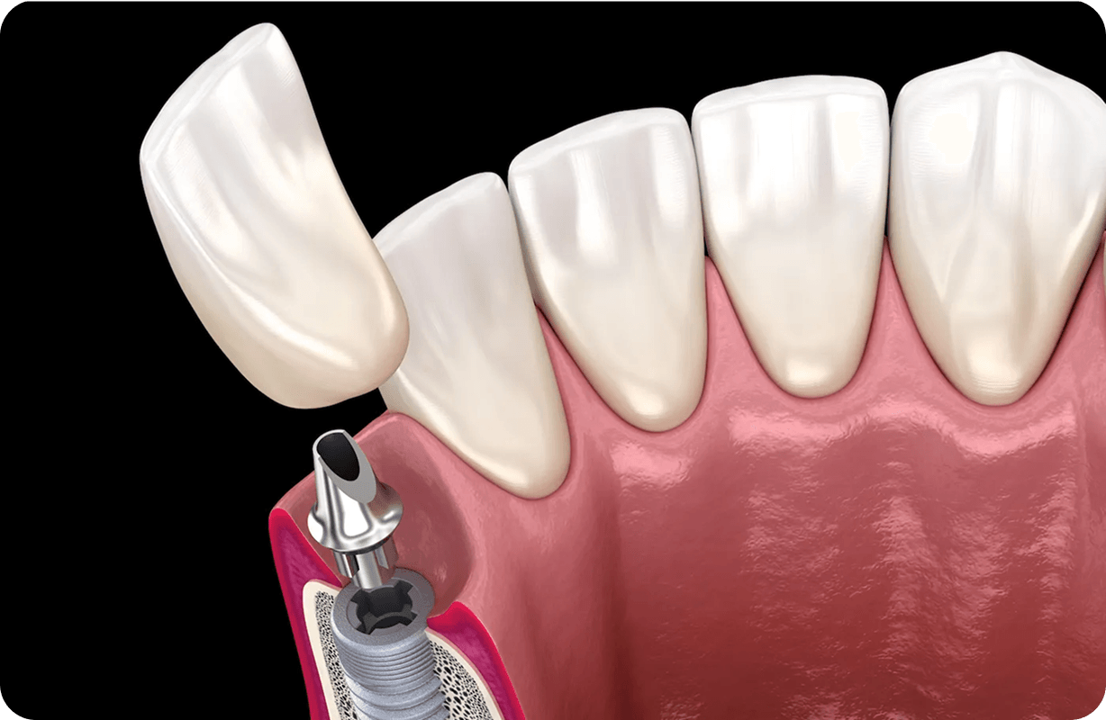 Oral & Maxillofacial Surgery